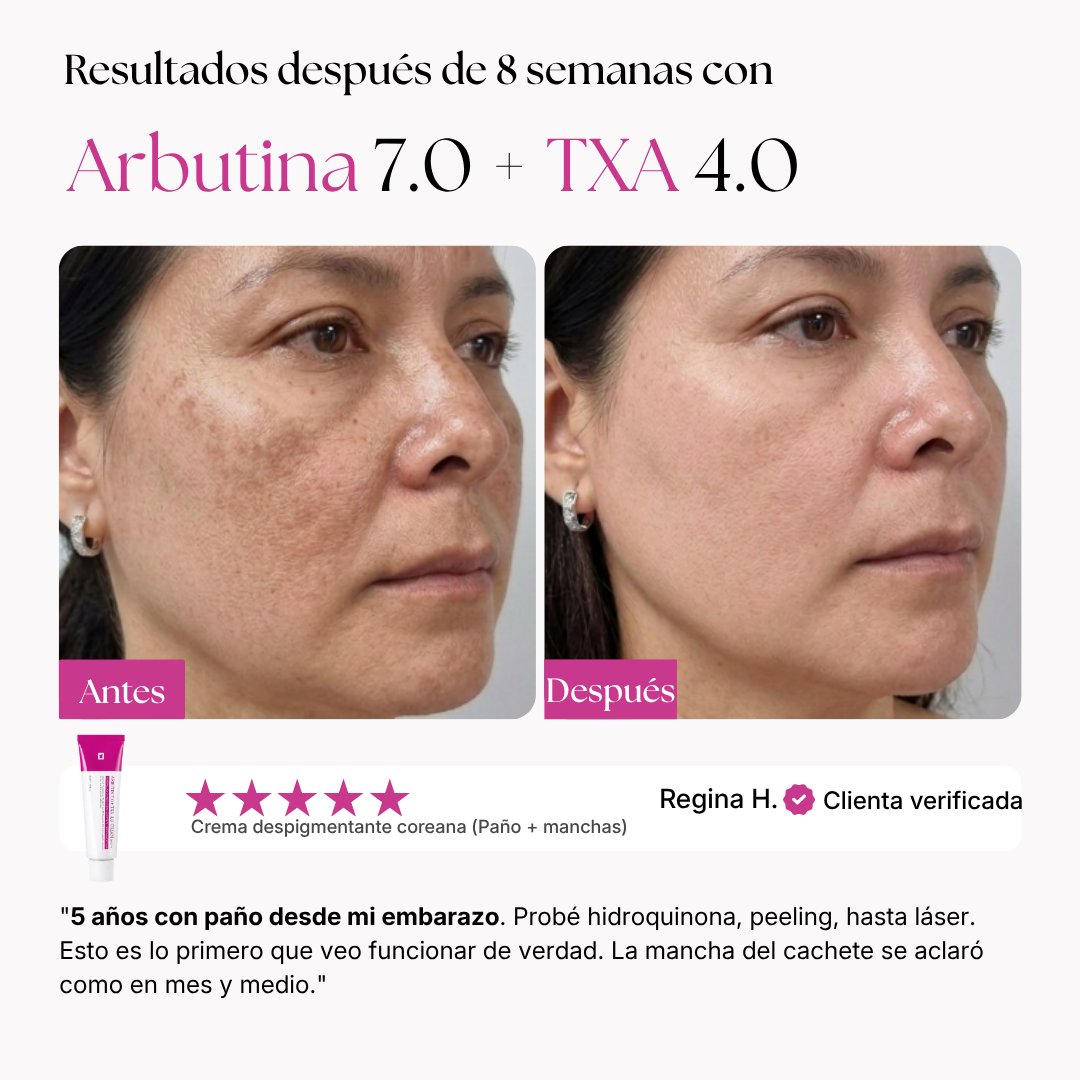AmalNur Anti-Paño · Fórmula 4 Vías