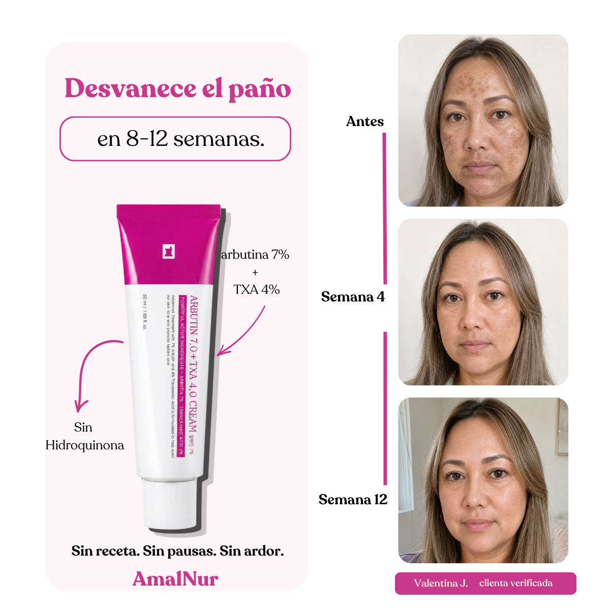 AmalNur Anti-Paño · Fórmula 4 Vías